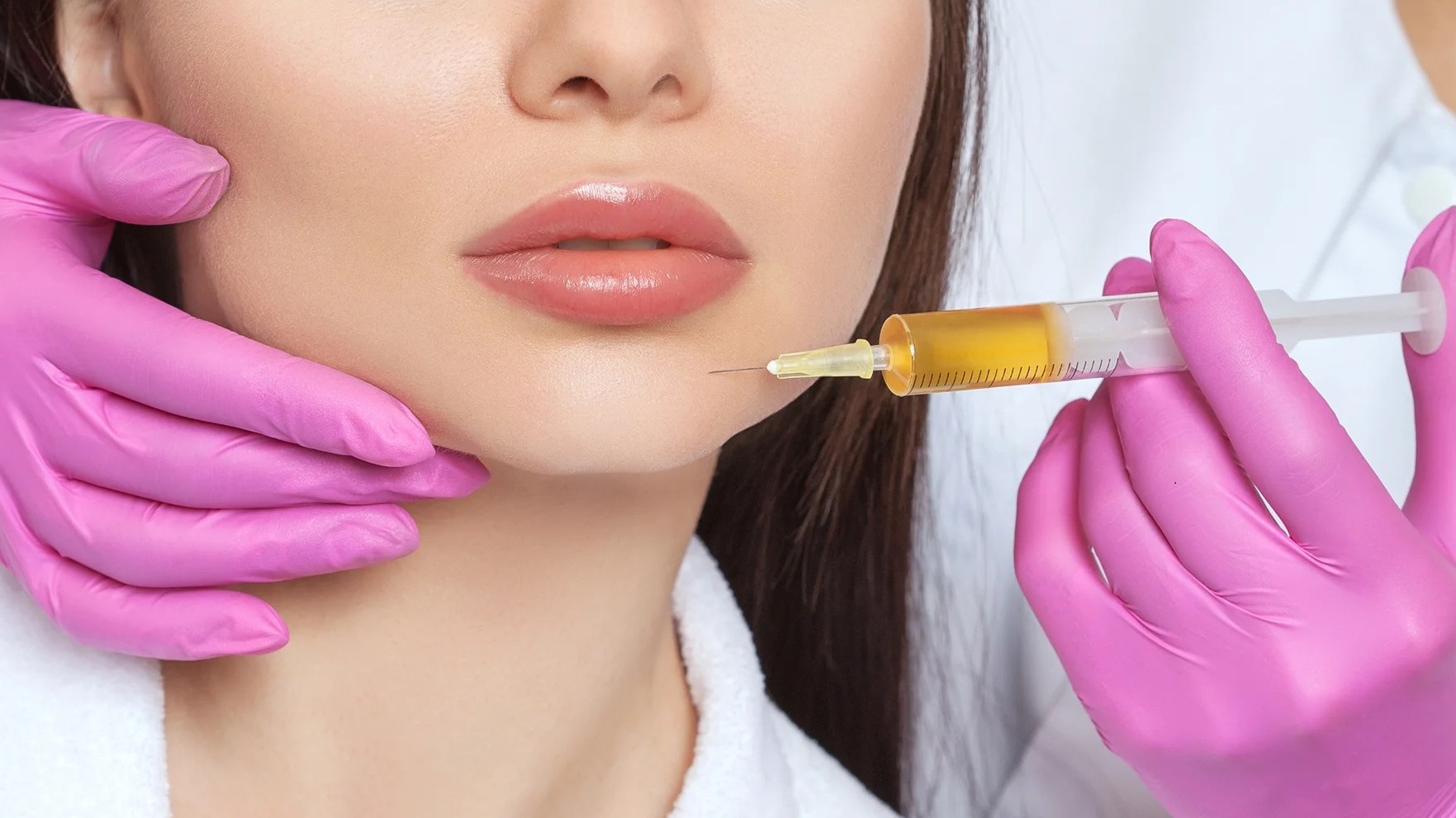 Góc làm đẹp: Tiêm filler cằm bao lâu thì đẹp tự nhiên? 