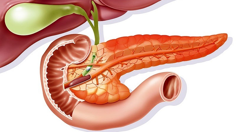 Tiêu chuẩn chẩn đoán viêm tụy cấp hiện nay