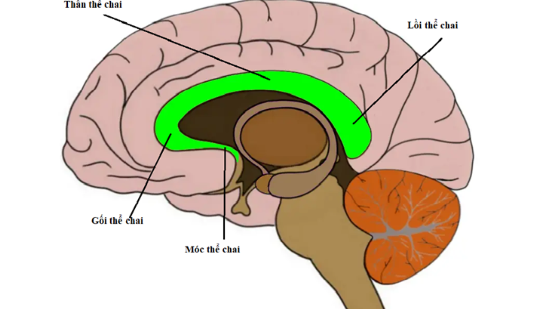 Bất sản thể chai là gì? Phát hiện bất sản thể chai trong thai kỳ phải làm sao?