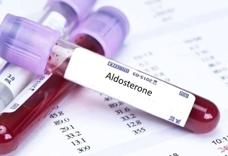 Cường aldosteron thứ phát là gì? Tìm hiểu "tất tần tật" về cường aldosteron thứ phát 4
