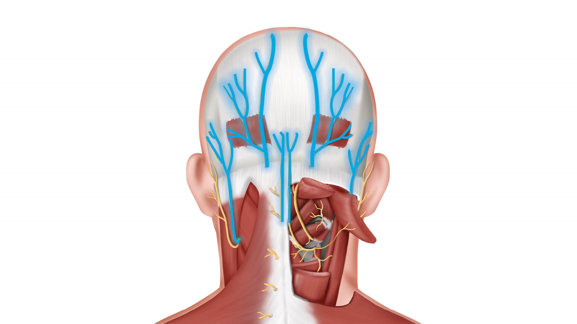 Dây thần kinh chẩm xuất phát từ đâu? Biểu hiện đau dây thần kinh chẩm