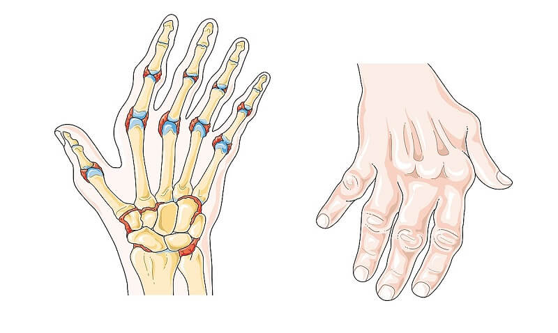 Tô mộc: Vị thuốc hoạt huyết hóa ứ4.jpg