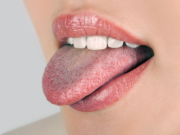 Top 4 thuốc trị nấm lưỡi hiệu quả nhất  1