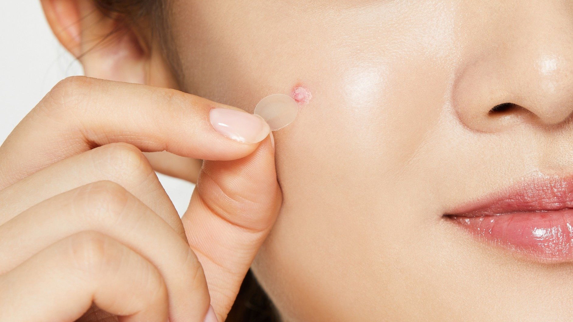 COSRX Acne Pimple Master Patch là loại miếng dán mụn nào và tác dụng của nó như thế nào?
