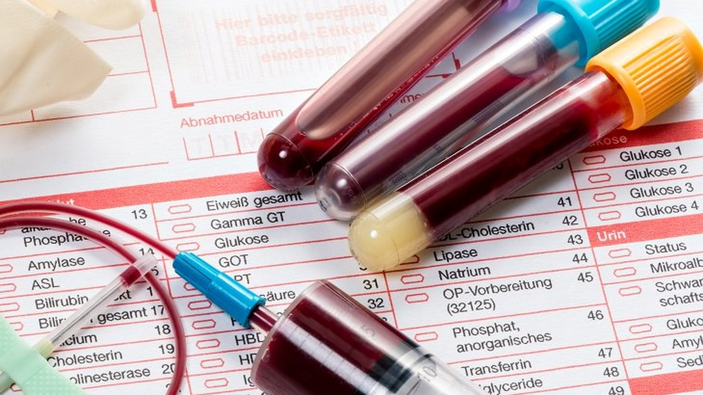 TS TC là gì? Hiểu rõ về các xét nghiệm đông máu trong chẩn đoán và điều trị bệnh