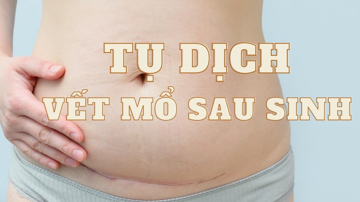 Tụ dịch vết mổ sau sinh có nguy hiểm không? 