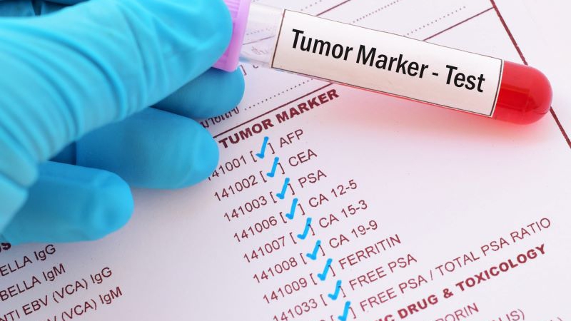 Tumor markers là gì? 6 ứng dụng của tumor markers đem lại trong lâm sàng 1
