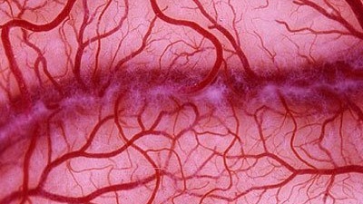 U lành tính có tăng sinh mạch máu không? Điều trị tăng sinh mạch máu trong ung thư