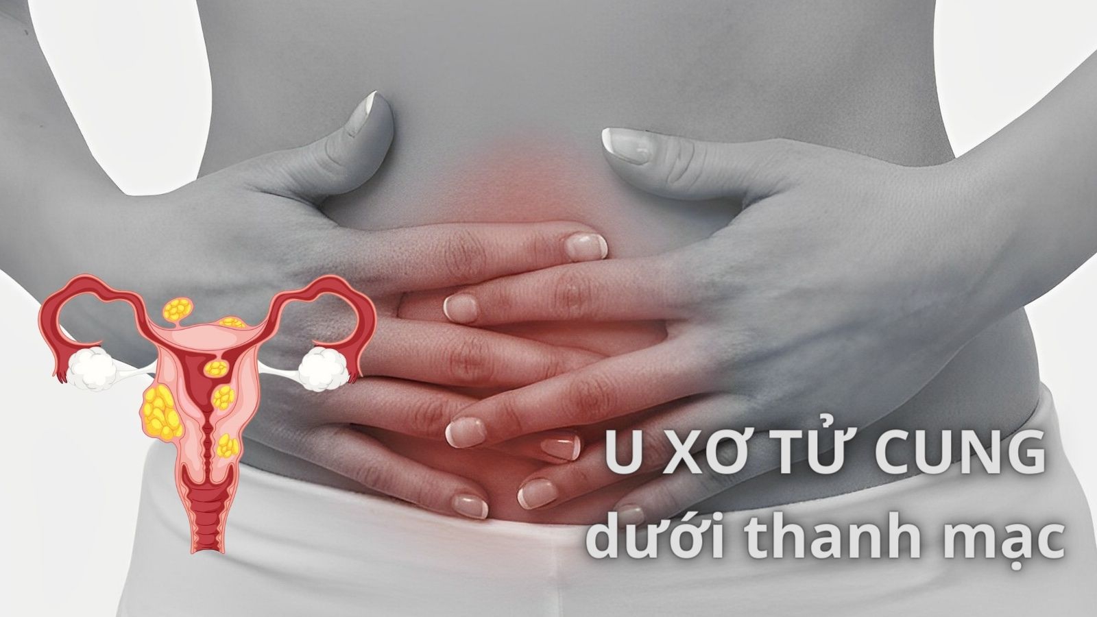 U xơ tử cung dưới thanh mạc có nguy hiểm không? 