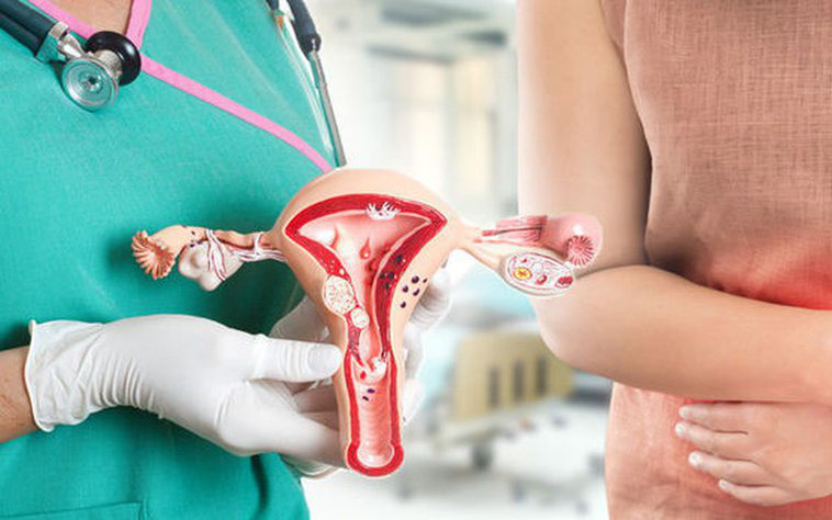 U xơ tử cung và lạc nội mạc tử cung bệnh nào nguy hiểm hơn? 1