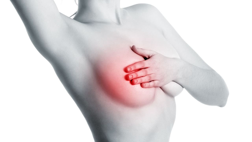 U xơ vú và những điều mà bạn cần biết