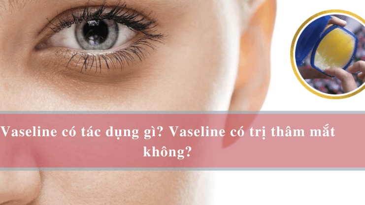 Có những lưu ý gì cần biết khi sử dụng Vaseline để trị thâm mắt?
