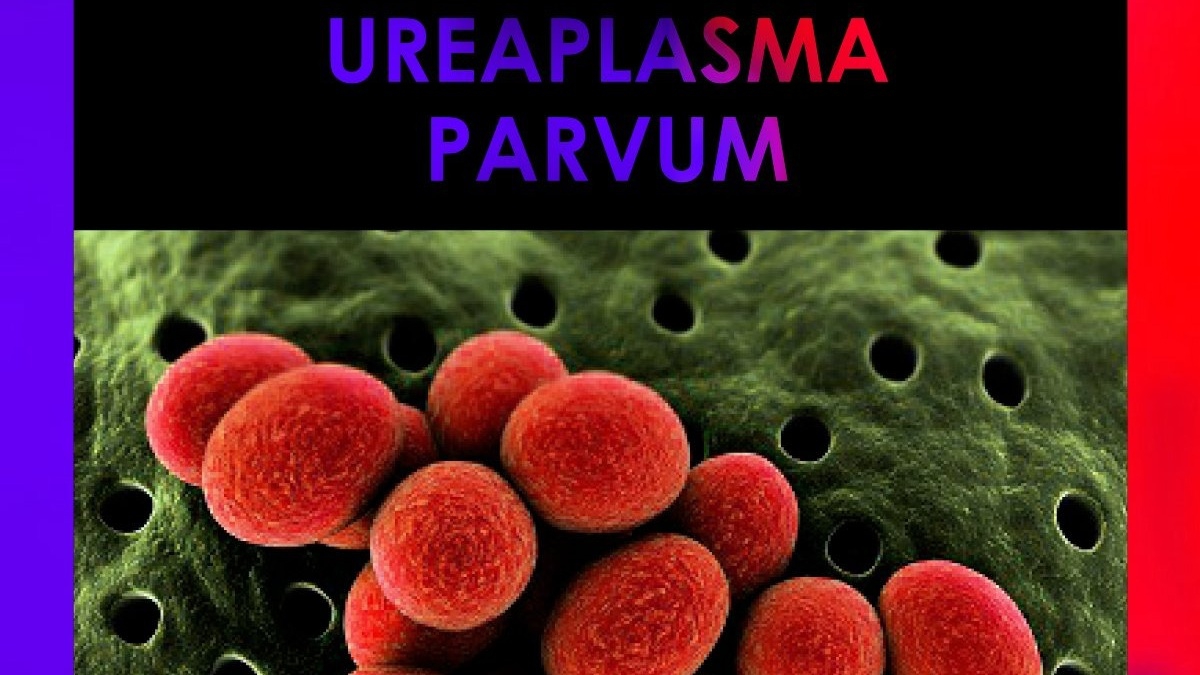 Ureaplasma Parvum là Bệnh gì?