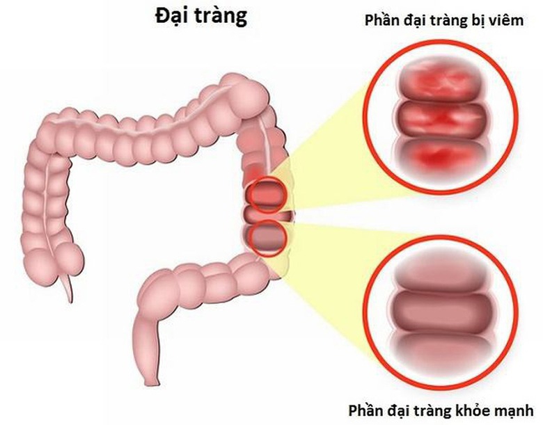 viem-dai-trang-co-an-duoc-lac-khong.jpg