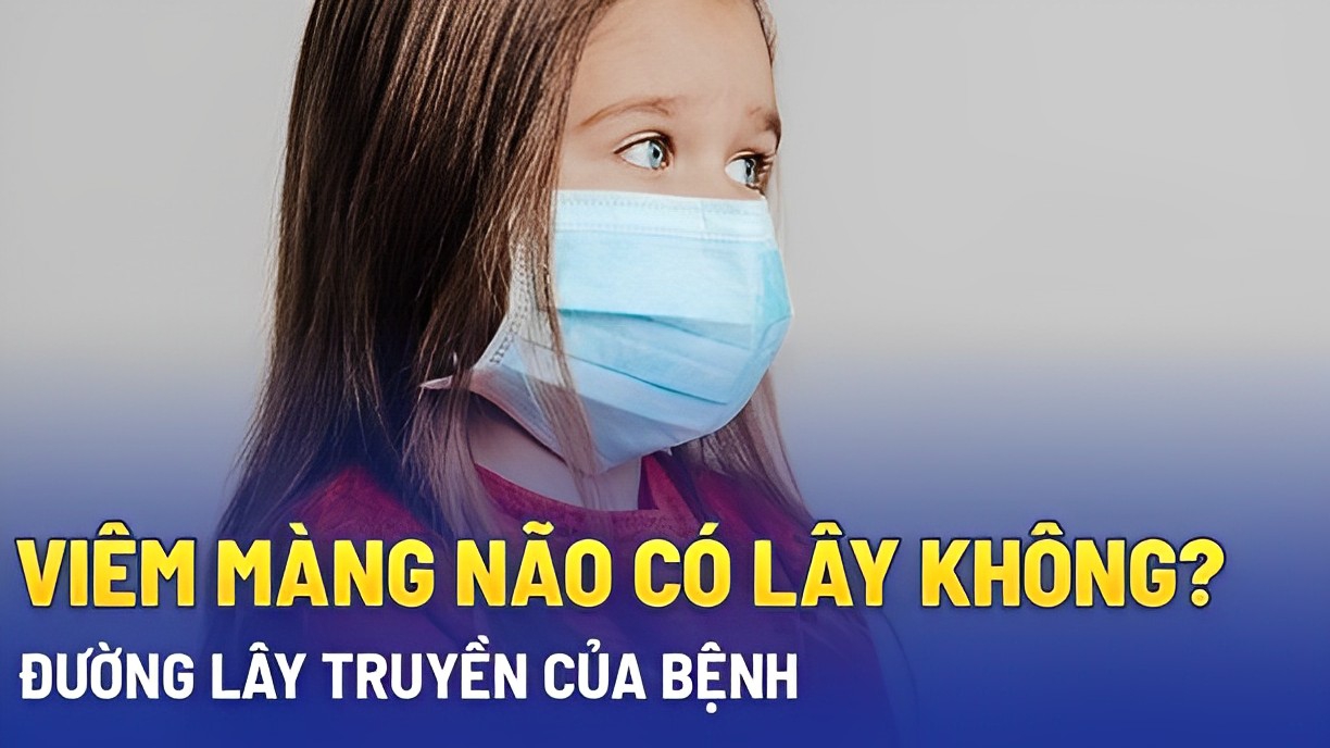 Bệnh viêm màng não có lây không? Lây qua còn đường nào?