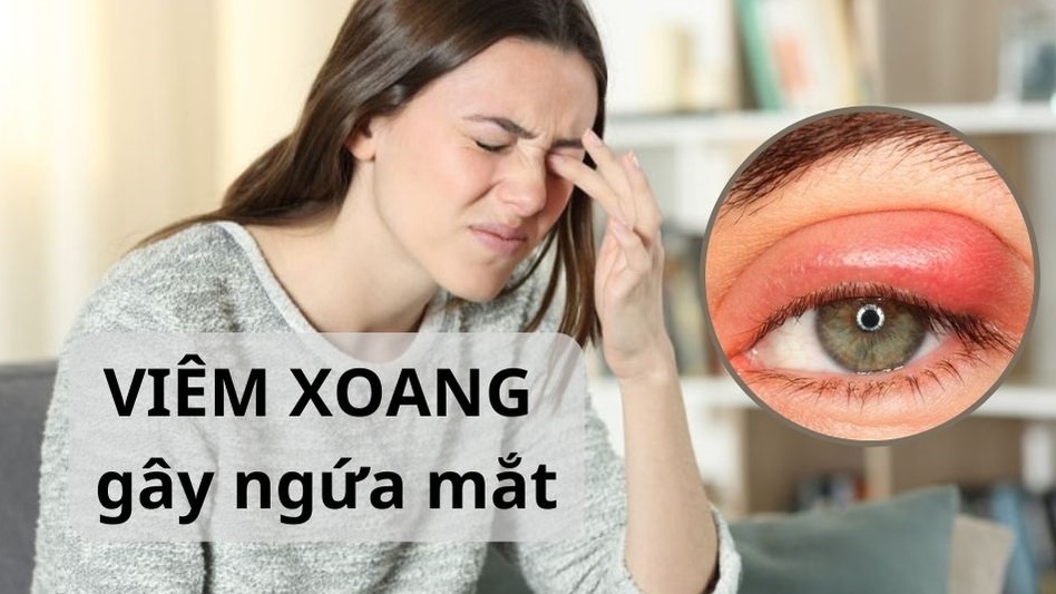 Lý giải tình trạng viêm xoang ngứa mắt