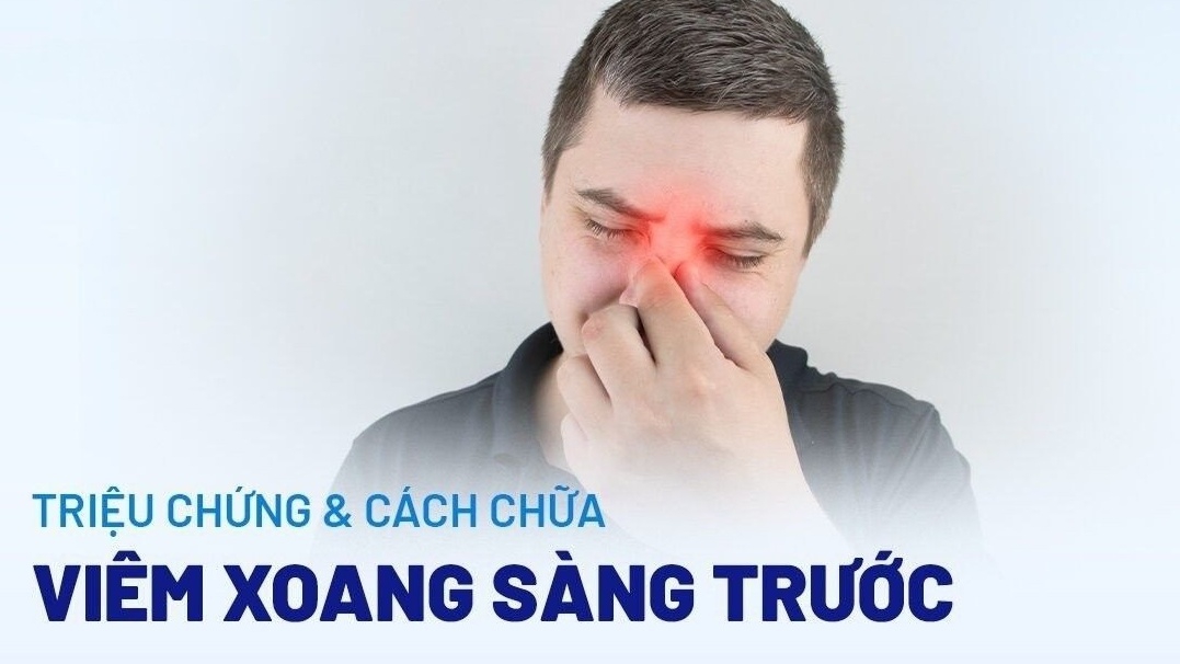 Bệnh viêm xoang sàng trước và những thông tin bạn cần biết