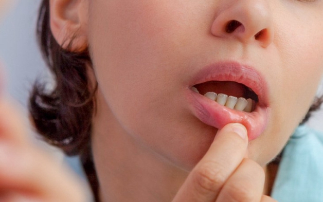 Vitamin C chữa nhiệt miệng được không? Cách bổ sung vitamin hiệu quả ai cũng nên biết 2