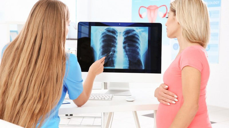 Vôi hóa phổi: Nguyên nhân và cách điều trị 1