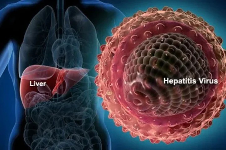 who-bao-dong-ve-tinh-trang-nhiem-trung-viem-gan-do-virus-cuop-di-sinh-mang-cua-3500-nguoi-moi-ngay-1.jpg