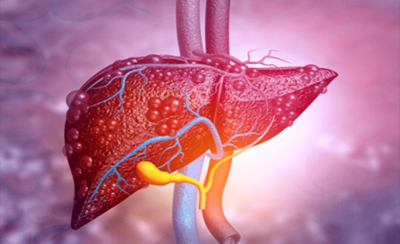 xet-nghiem-alpha-1-antitrypsin-aat-la-gi 1.jpg