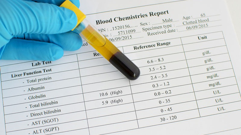 Chỉ số xét nghiệm chức năng gan: Tất cả những điều bạn cần biết