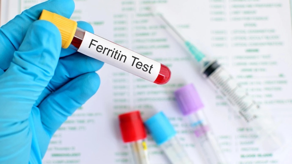 Khi nào cần làm xét nghiệm ferritin?