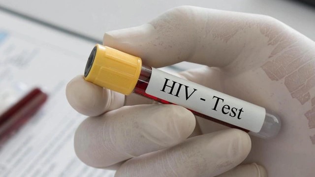 Xét nghiệm HIV có cần nhịn ăn không 1