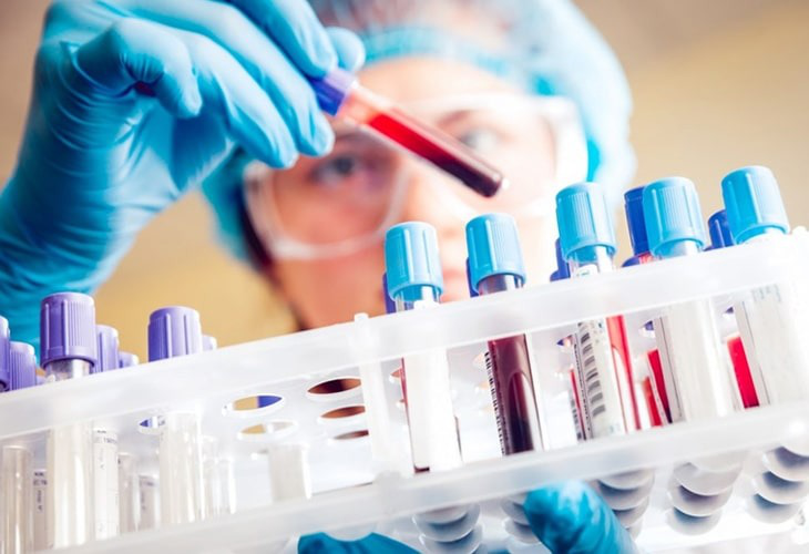 Xét nghiệm máu có phát hiện vi khuẩn HP không? 3
