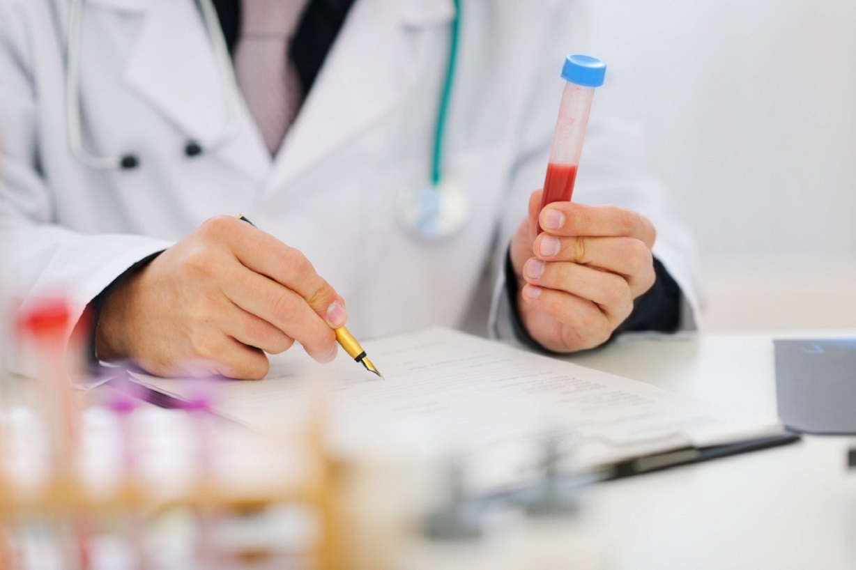 Độ tin cậy của kết quả xét nghiệm máu phát hiện bệnh sởi là bao nhiêu?
