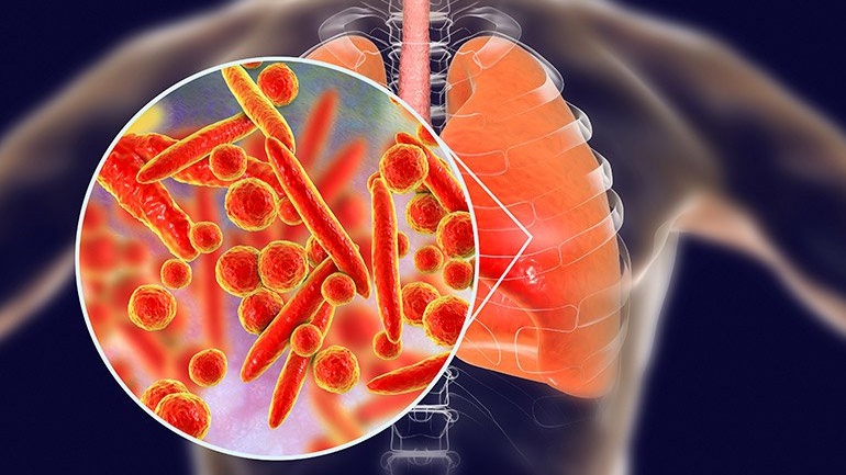 Phương pháp xét nghiệm Mycoplasma và các điều cần biết về Mycoplasma