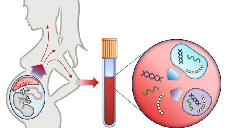 Thông tin về 2 phương pháp xét nghiệm NIPT và Double Test 1