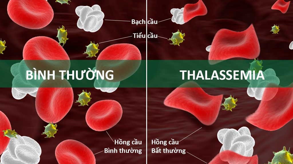 Xét nghiệm Thalassemia có mất thời gian không?