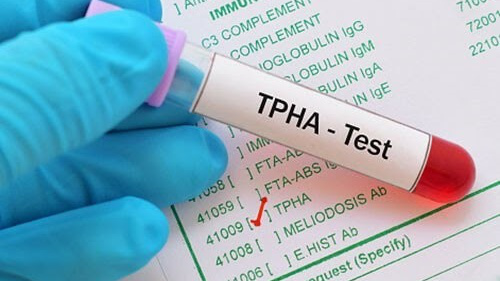 Xét nghiệm TPHA trong chẩn đoán bệnh giang mai 2