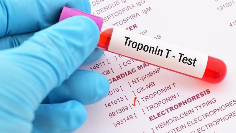 Xét nghiệm troponin – Phương pháp chẩn đoán nhồi máu cơ tim 3