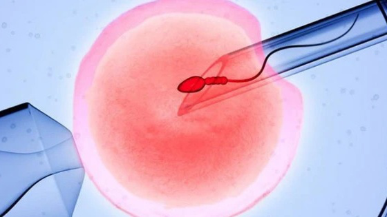 Xin trứng làm IVF ở đâu? Cần chuẩn bị gì trước khi xin trứng? 1