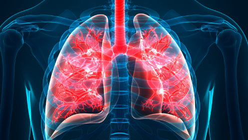 Điều trị xơ phổi bao gồm những phương pháp nào?
