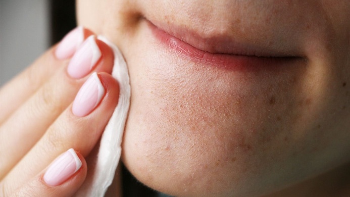 10 cách tự nhiên để trị mụn cám quanh miệng 