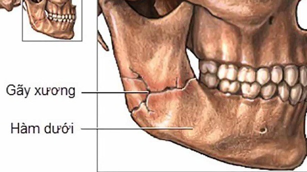  Xương hàm dưới: Giải phẫu, chức năng và một số bệnh liên quan 3