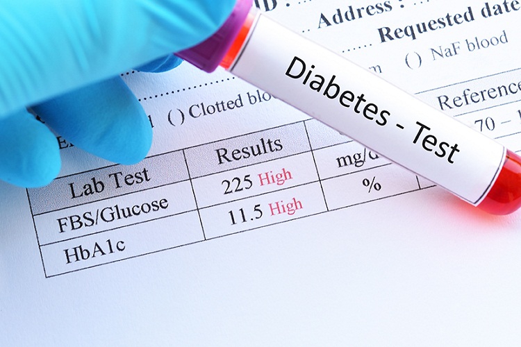 Có những loại xét nghiệm tiểu đường nào? Ý nghĩa của các xét nghiệm tiểu đường 1