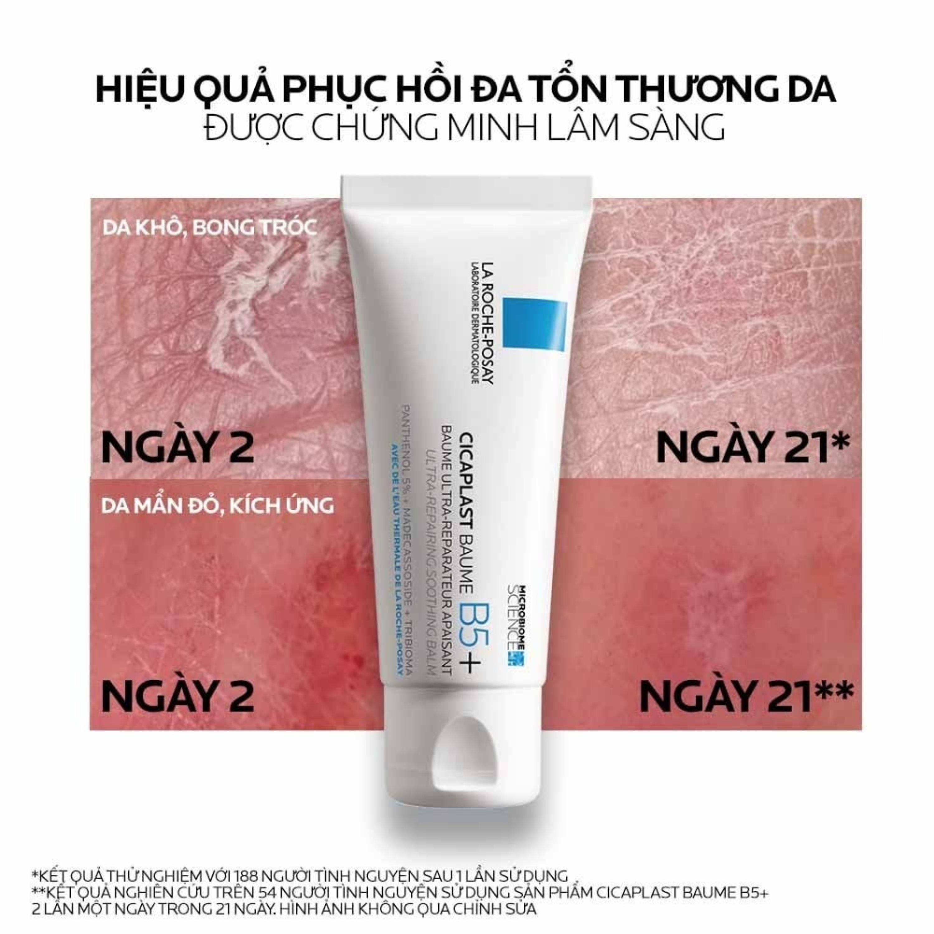 Hình ảnh Kem bôi phục hồi và dịu da La Roche-posay Cicaplast Baume B5+ 100ml