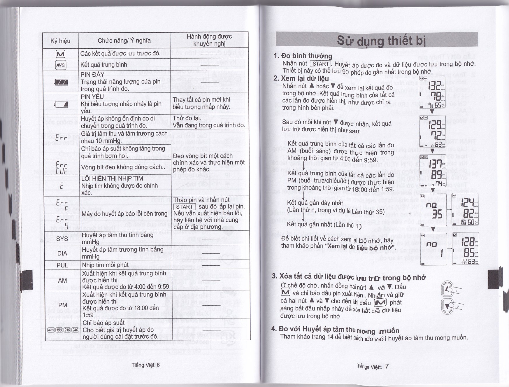 Hình ảnh Máy đo huyết áp bắp tay tự động AND UA-1020 hỗ trợ đo huyết áp, cảnh báo đột quỵ