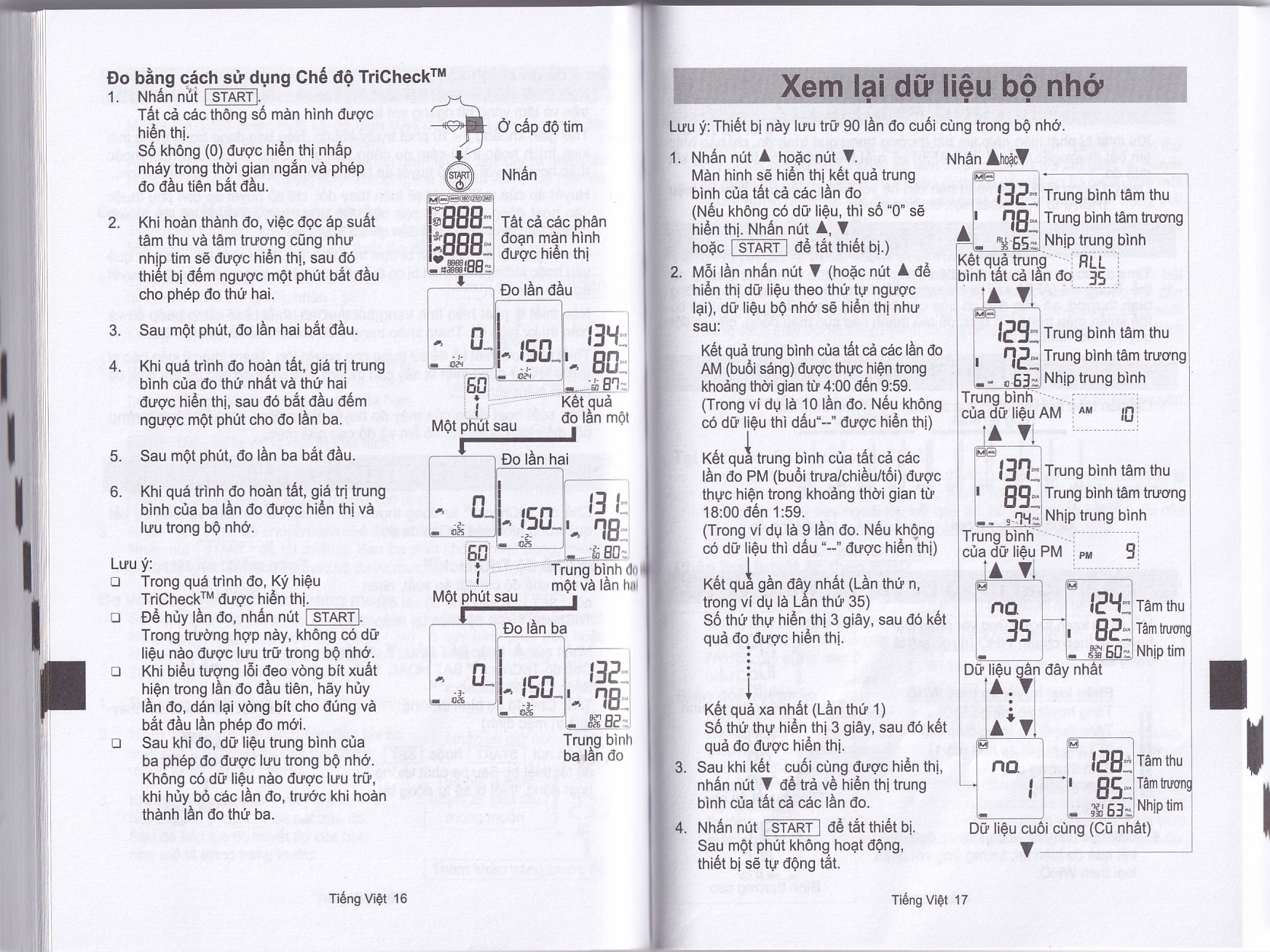 Hình ảnh Máy đo huyết áp bắp tay tự động AND UA-1020 hỗ trợ đo huyết áp, cảnh báo đột quỵ
