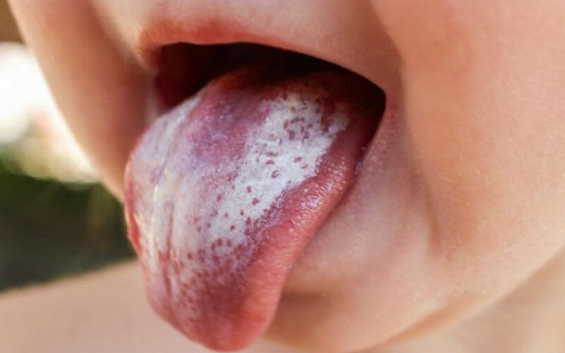 10 lợi ích của sữa nghệ không phải ai cũng biết 5