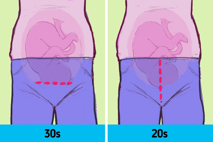 10 lợi ích và rủi ro bạn có thể gặp phải nếu sinh con ở độ tuổi 20 so với tuổi 30 3