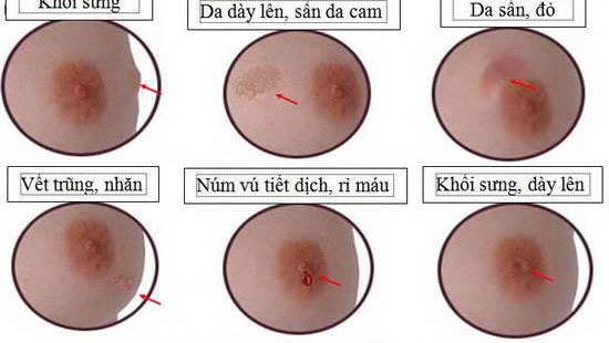 Núm vú và những vấn đề thường gặp 5