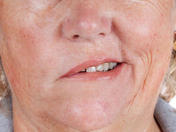 tai-sao-lai-bong-dung-meo-mat-nguyen-nhan-gay-meo-mat-va-cach-phong-ngua 3