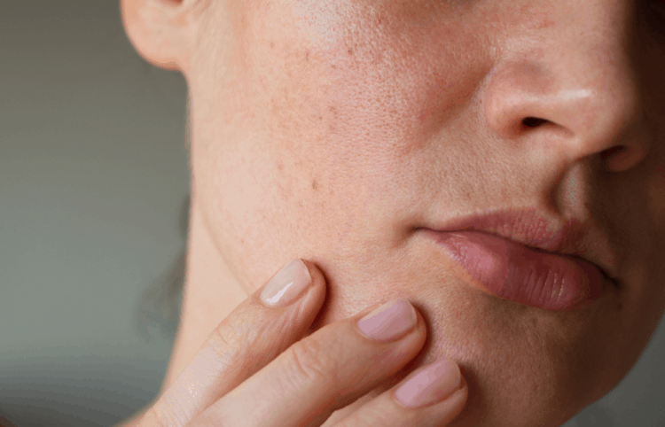 Dipotassium Glycyrrhizate là gì? Công dụng của Dipotassium Glycyrrhizate trong mỹ phẩm.3