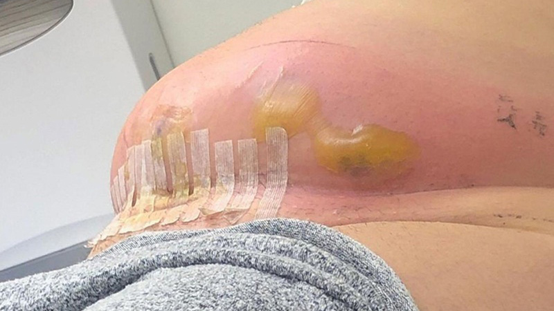 Tổng quan về siêu âm vết mổ sau sinh cùng những biến chứng bạn cần biết 2