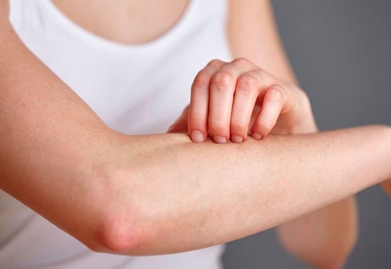 xuat-hien-vet-tron-bi-noi-dom-do-tren-da-va-ngua-la-do-dau 3